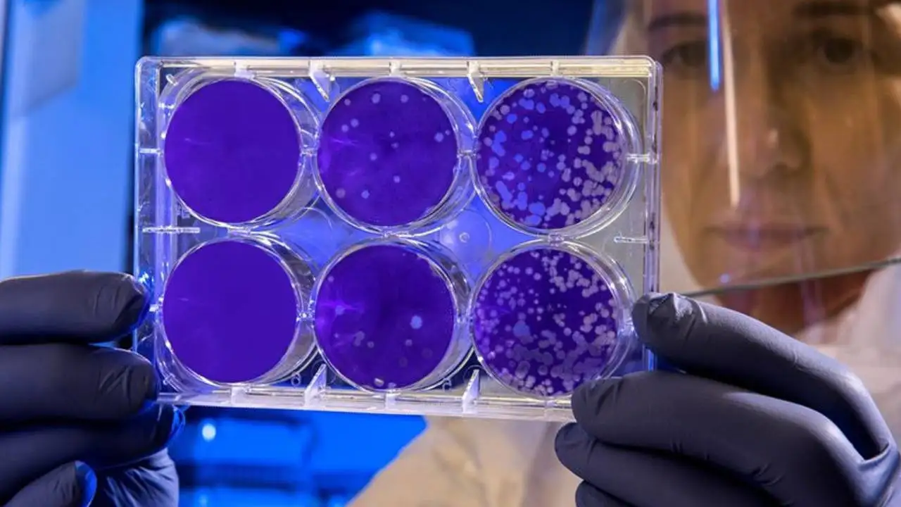 Yolcu Gemisindeki Ölümlerin Ardından DSÖ Harekete Geçti: Hantavirüse Yakın Takip
